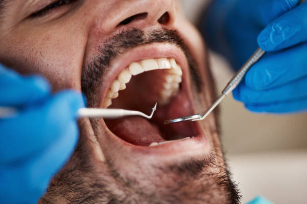 Best Pediatric Emergency Dentist in Pamplico, SC